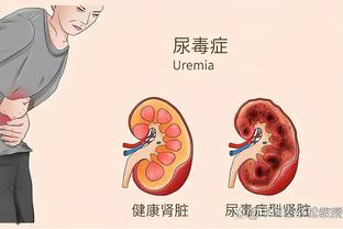 无解表现！唐斯半场5中5拿到15分11篮板